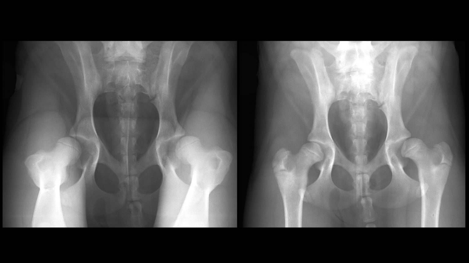 Hip Dysplasia KYON