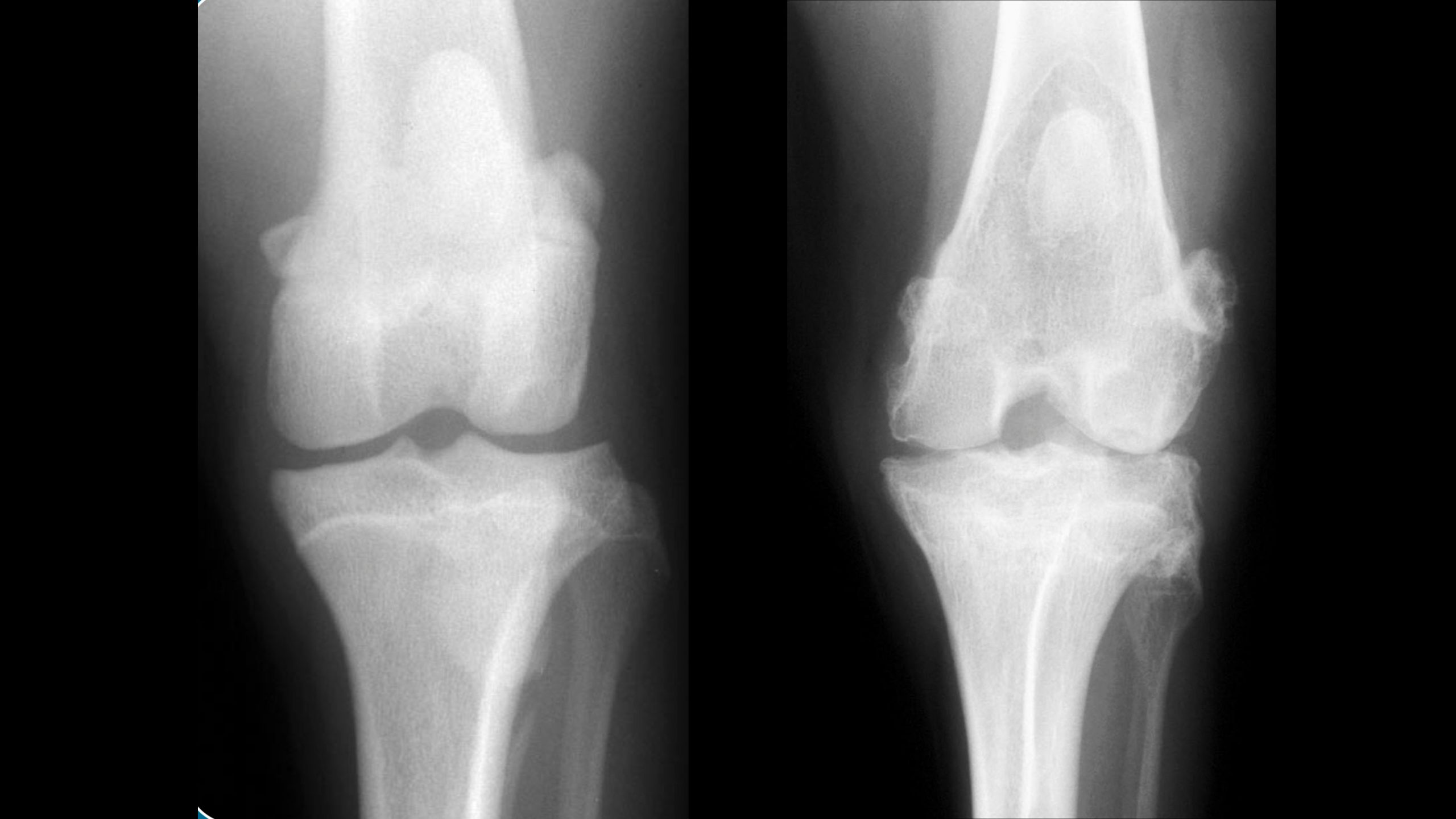 Confronto radiografico di un ginocchio di cane sano e artritico