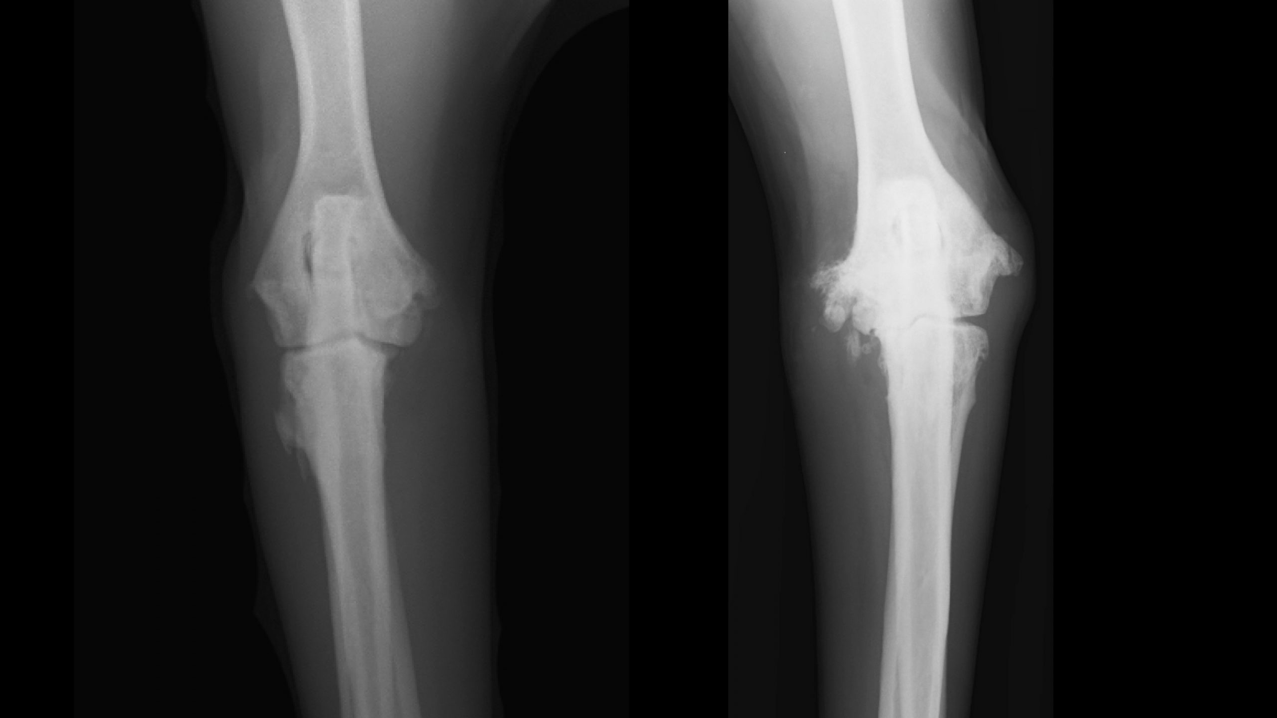 how to treat elbow dysplasia in dogs