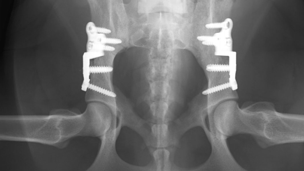 tpo surgery