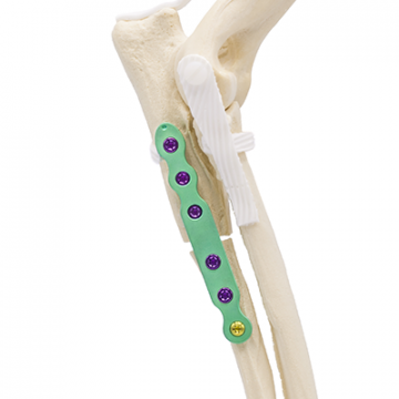 Proximaal ontvoerende ulnaire osteotomie-implantaat op een hondenskelet