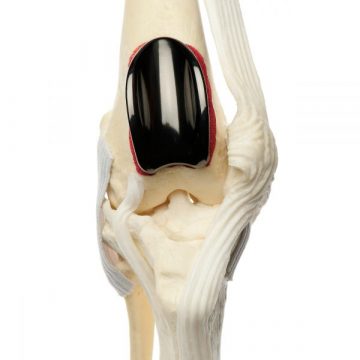 veterinary patellar groove replacement implanted on the knee cap of a canine skeleton