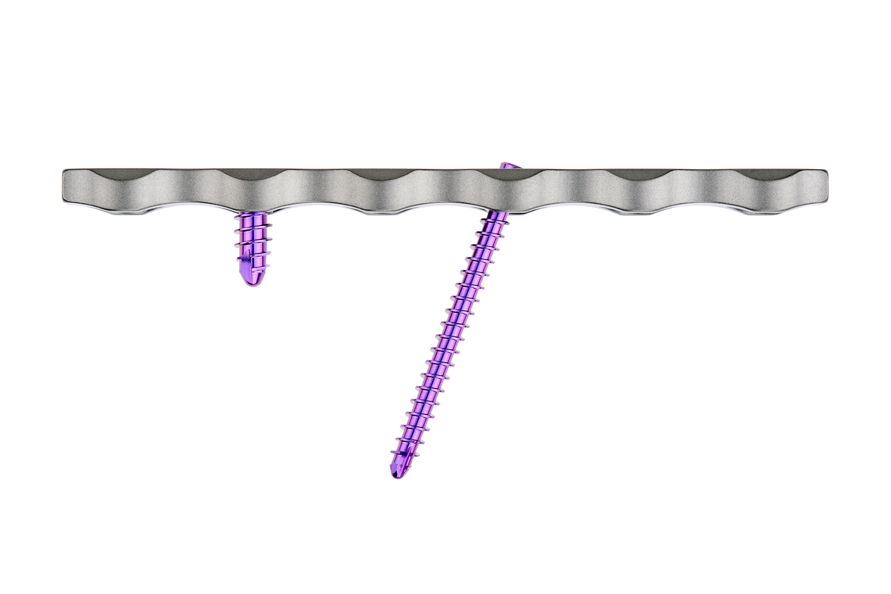 Angulated Locking Screws on a Fracture Plate