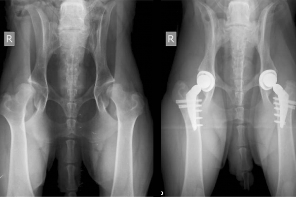 Pre and Post Operative Luxation Hip with Dual Mobility Cup